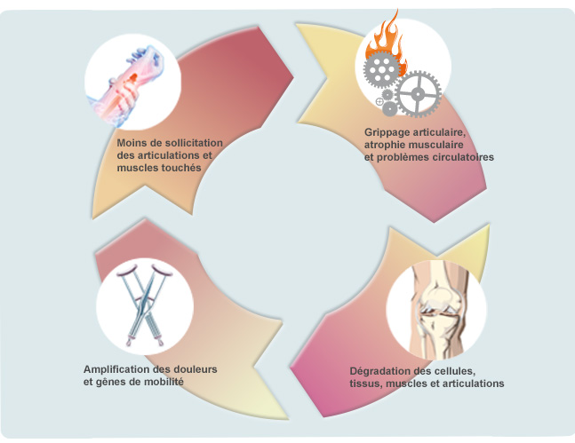 Arthrose : les articulations les plus touchées par l'arthrose - Arthrolink