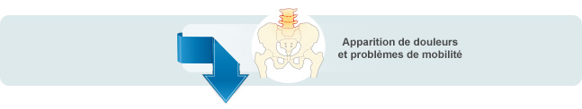 la douleur et les problèmes de mobilité
